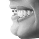 invisalign_bw_profile