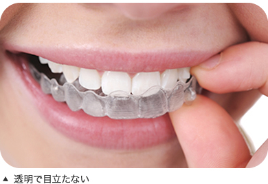 インビザライン（Invisalign）について